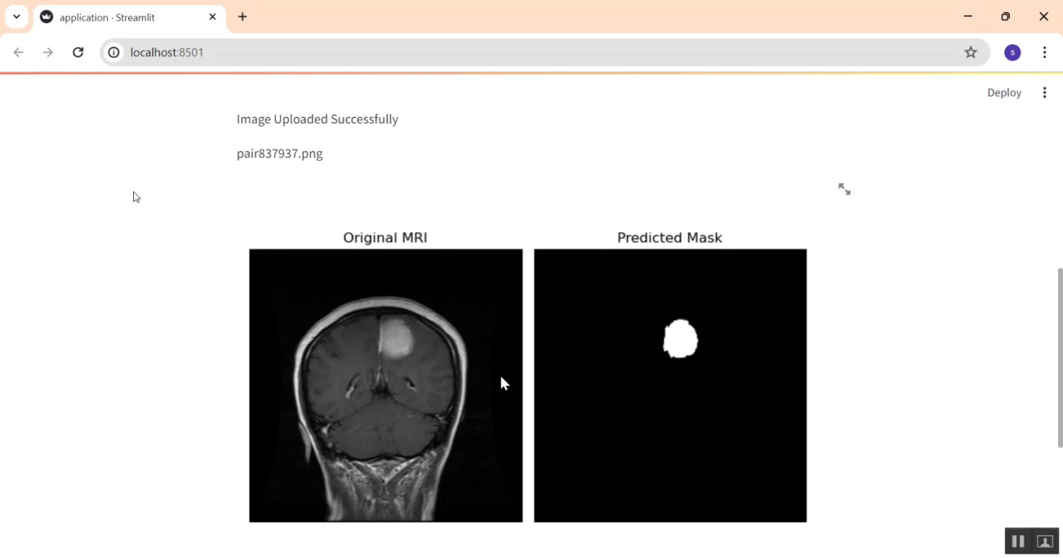 Brain MRI image Segmentation in Python Projects