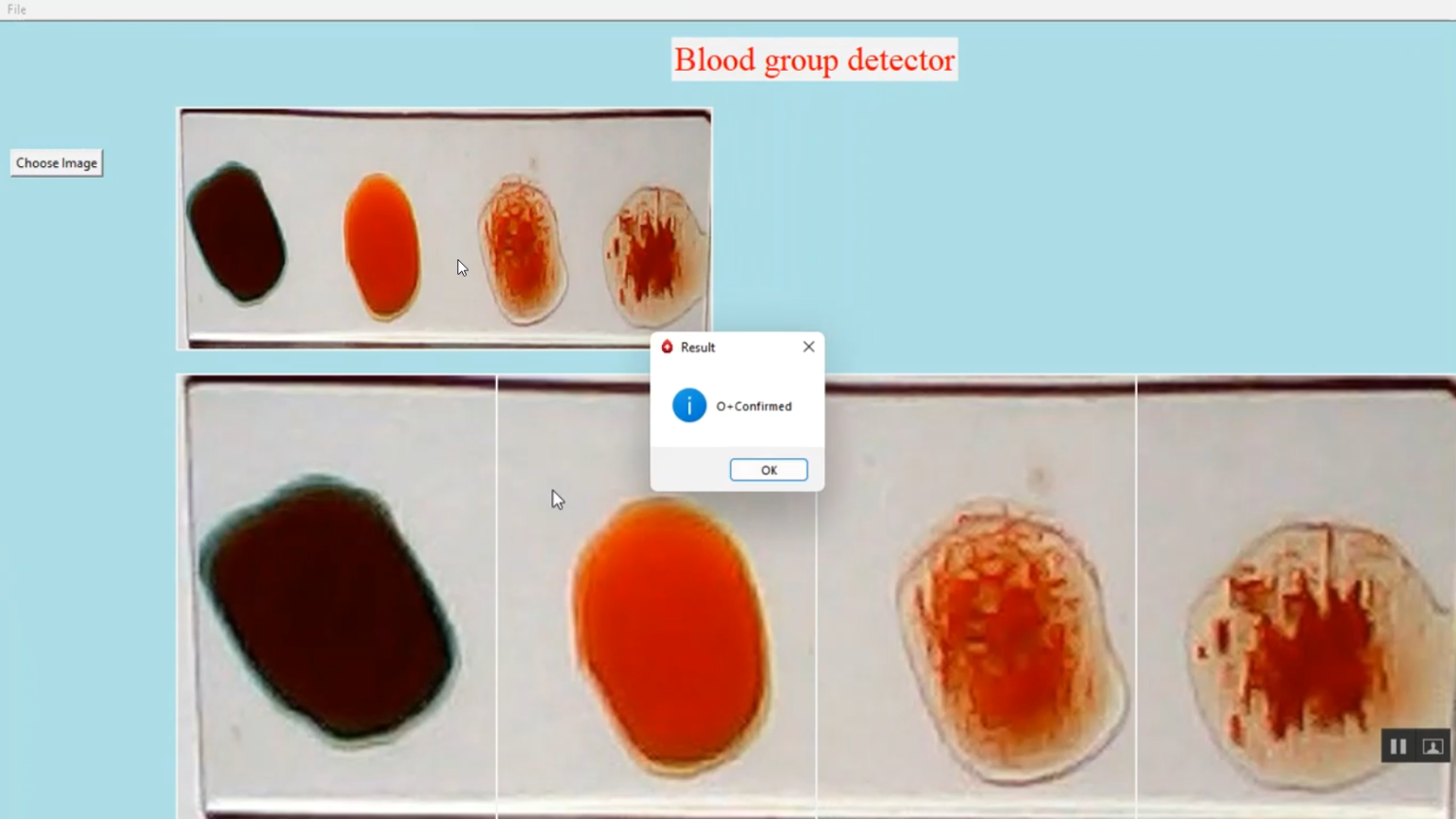 Blood Group Detection in Python Projects