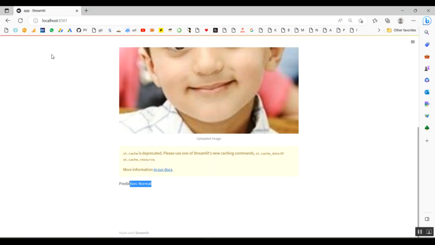 Face Normal Abnormal Classification Streamlit in Python Projects