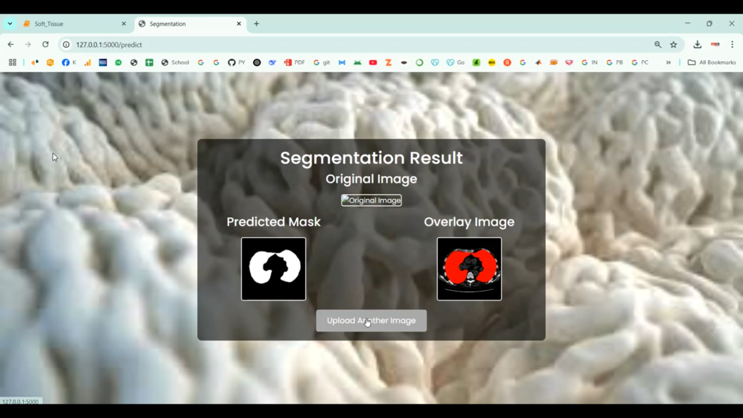 Soft Tissue Segmentation using Image Dataset in Python Projects