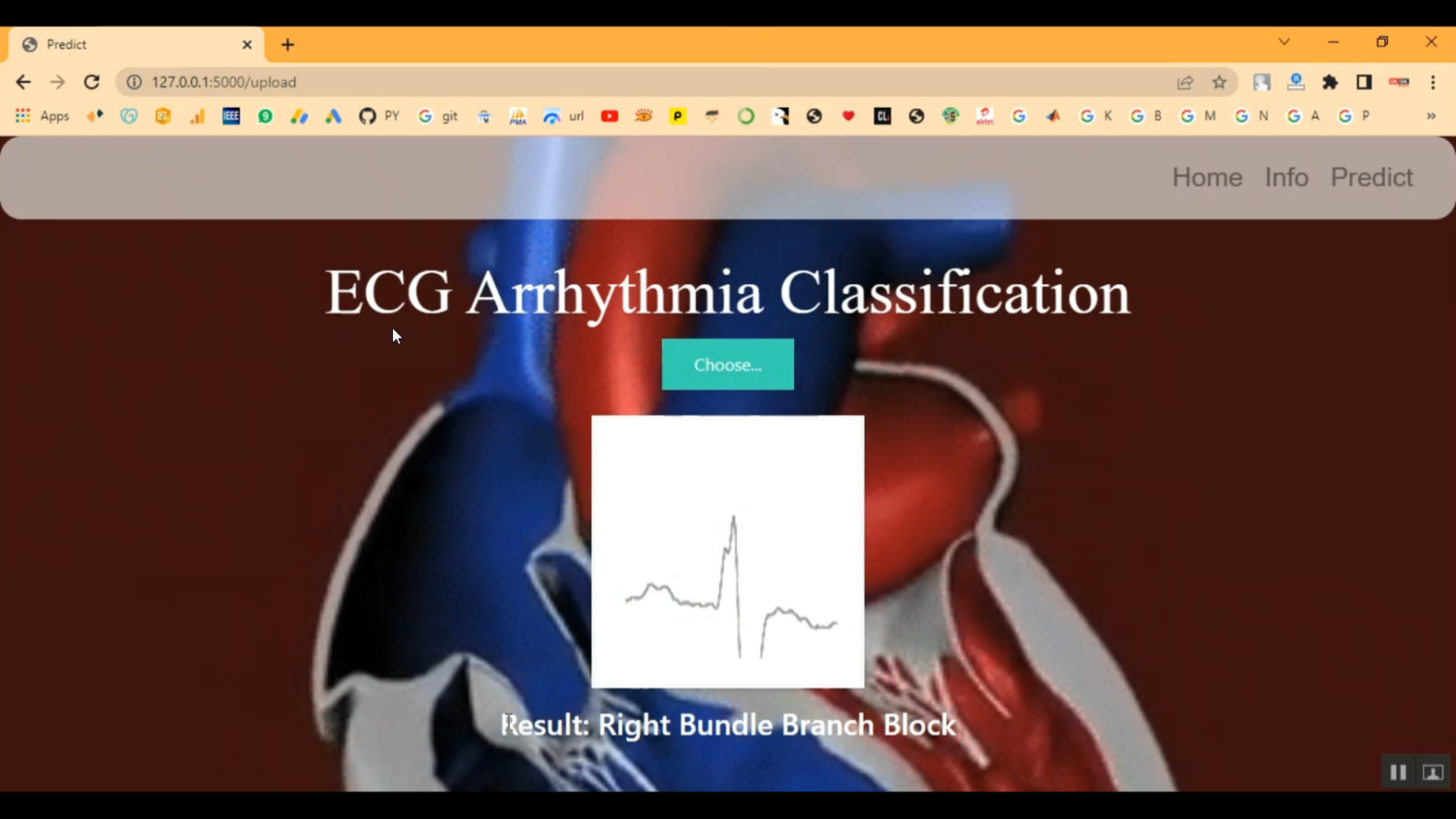 ECG Heart Beat using Image Classification in Python Projects