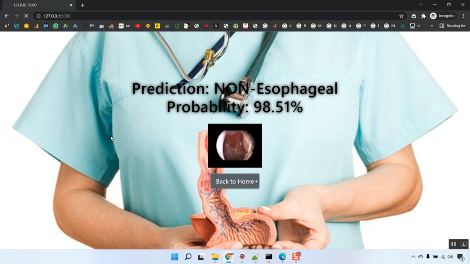 Esophageal Fusion Image Classification CNN Flask App in Python Projects