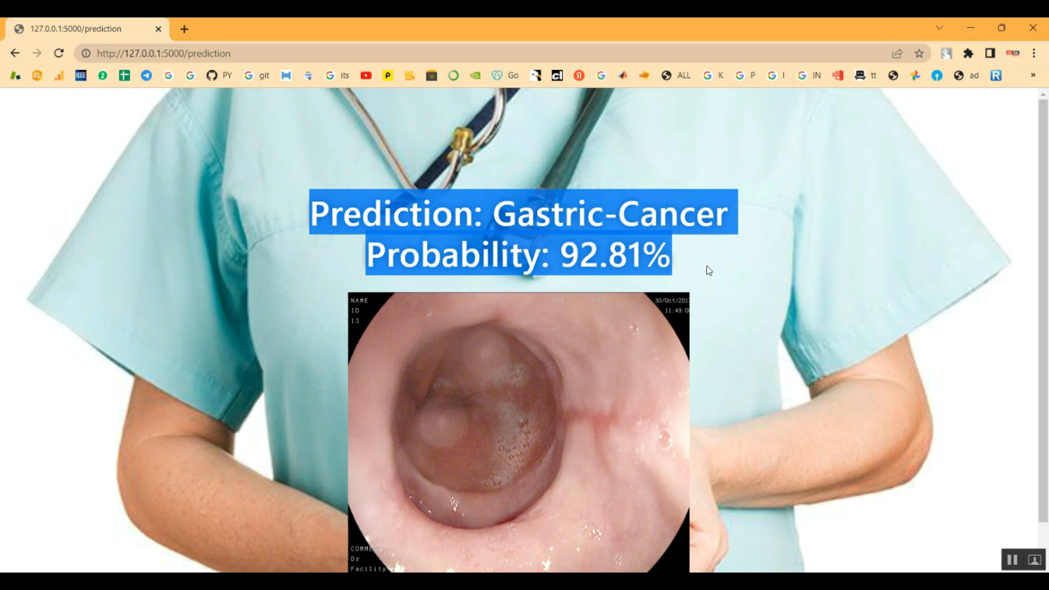 EHR Gastric Cancer in Python Projects
