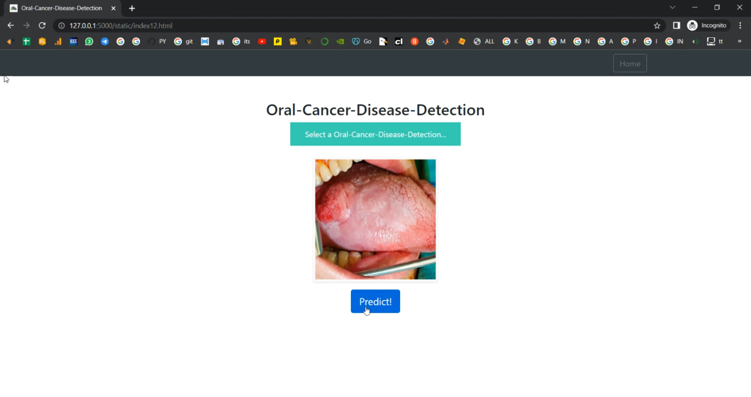 Oral Cancer Train CNN in Python Projects