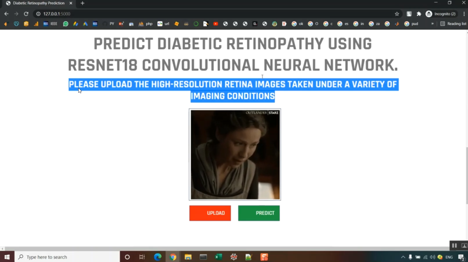 Diabetic Retinopathy Inception in Python Projects