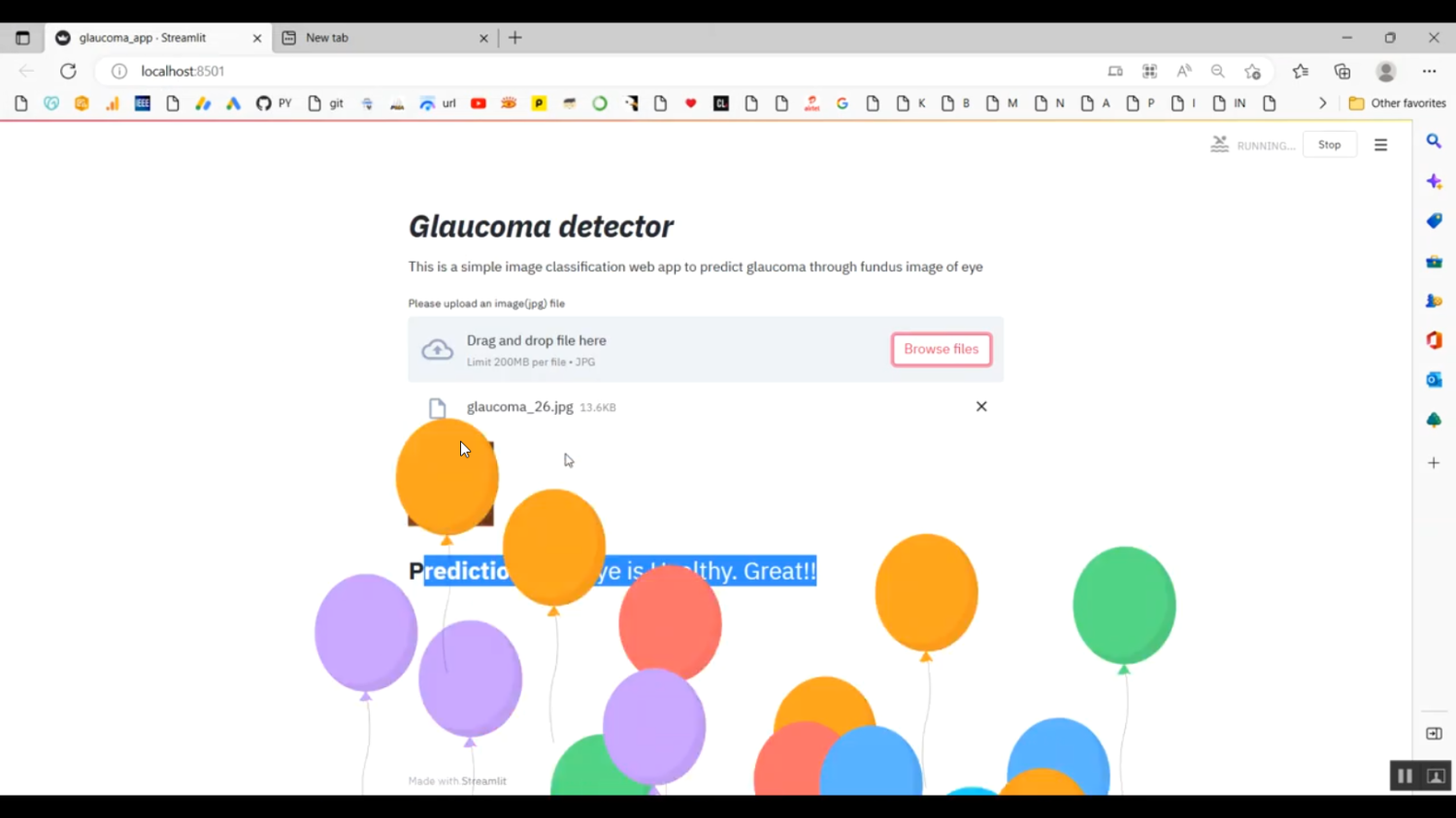 Glaucoma Disease Prediction Image Classification Streamlit in Python Projects