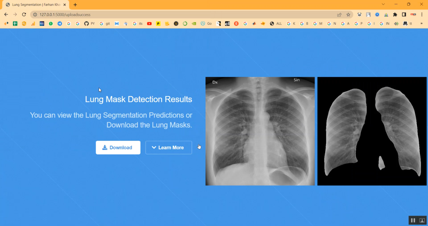U NET Lung Cancer in Python Projects