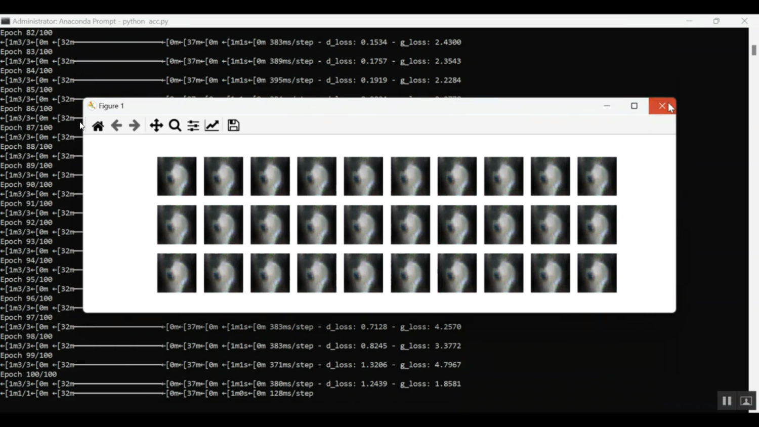 Bone Catolico Classification in Python Projects