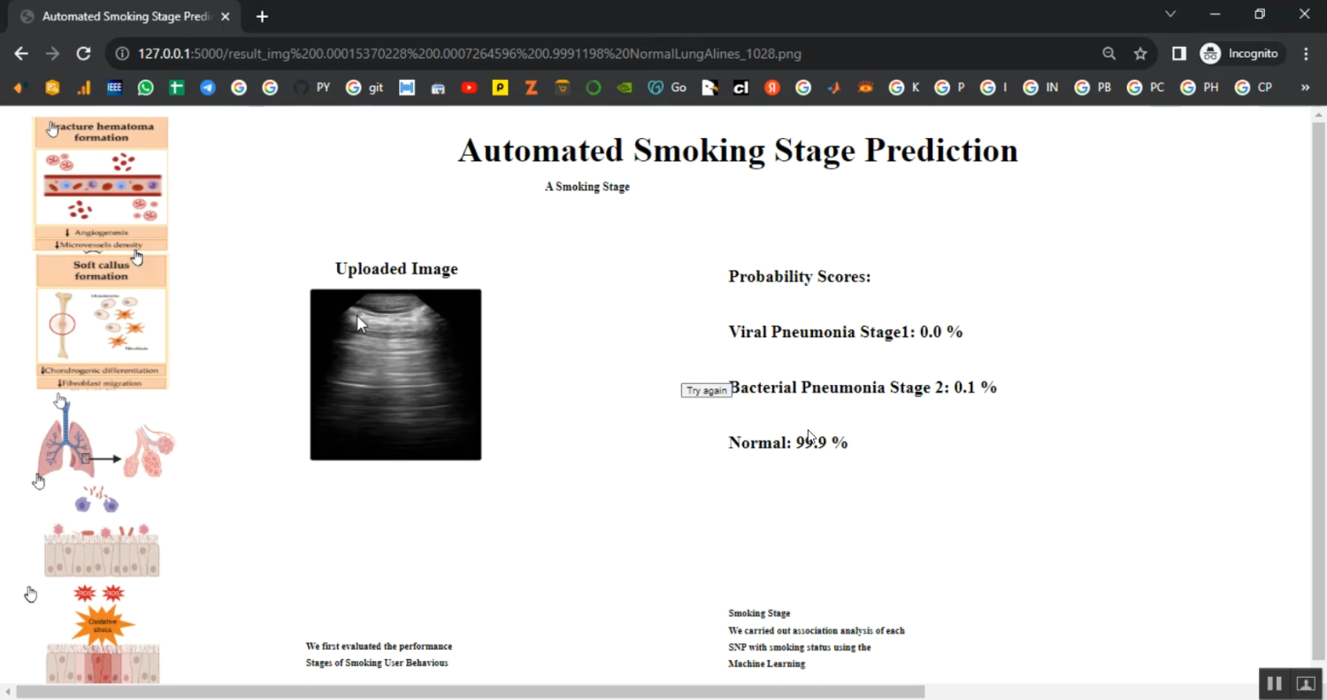 Lung Smoking Automated Stage Prediction Streamlit in Python Projects