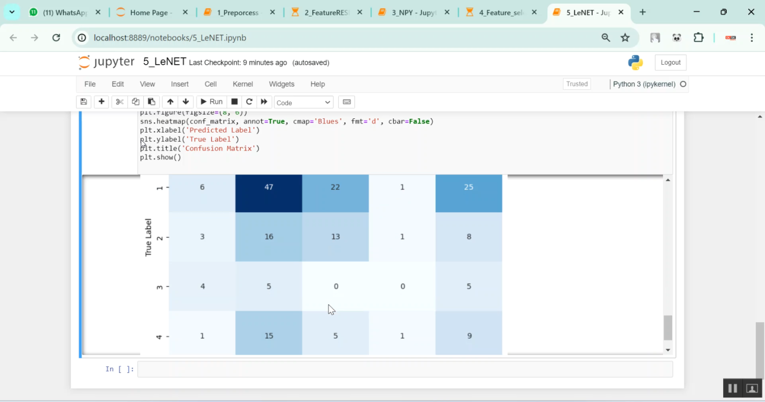 Alzheimer Disease Using Deep Neural Network using MRI Image in Python Projects