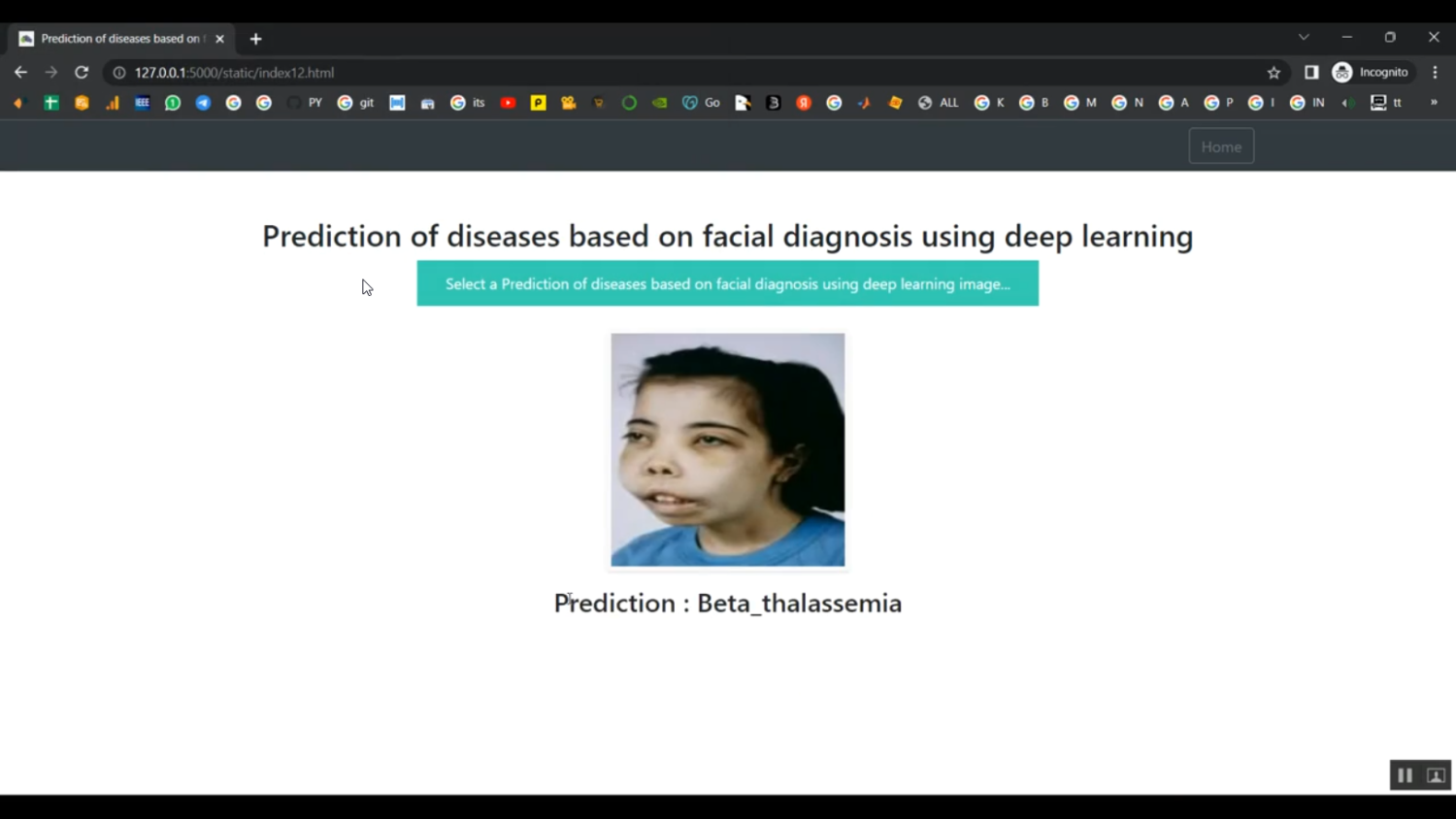 Face Disease CNN Train Streamlit App in Python Projects