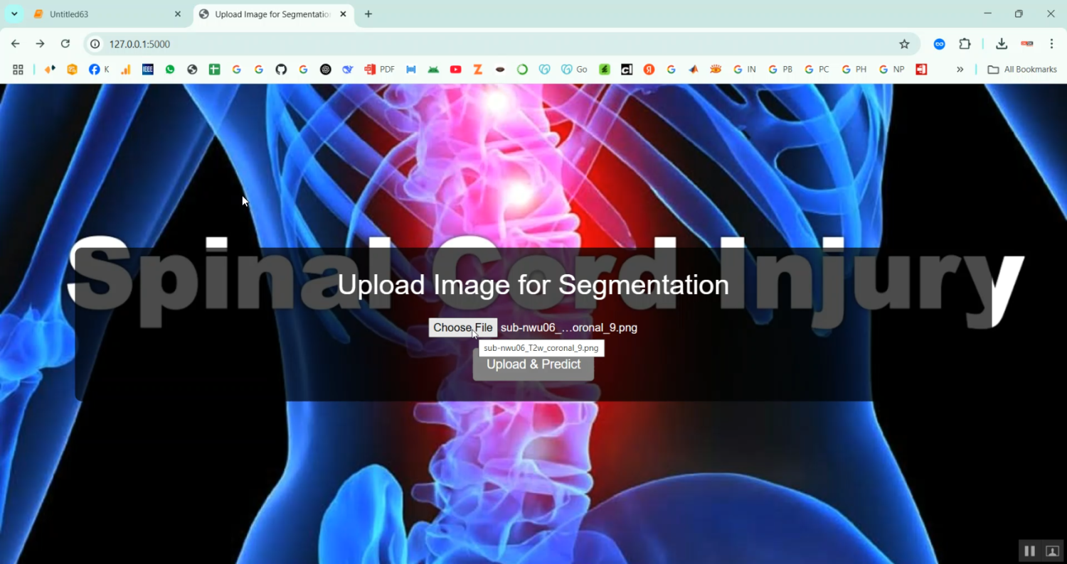 Spinal Cord Injury Detection in Python Projects