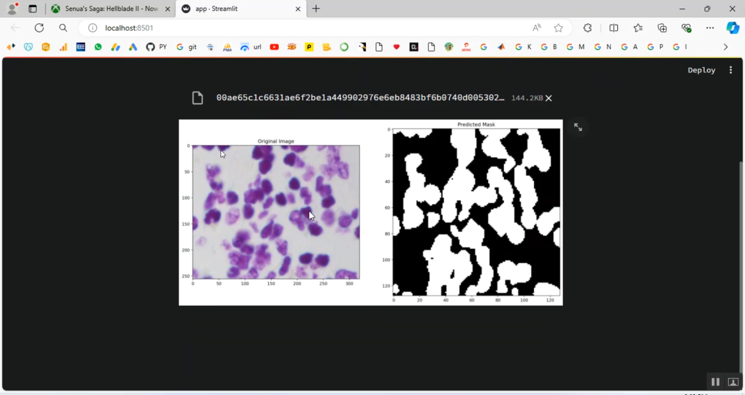 Biomedical Image Segmentation in Python Projects