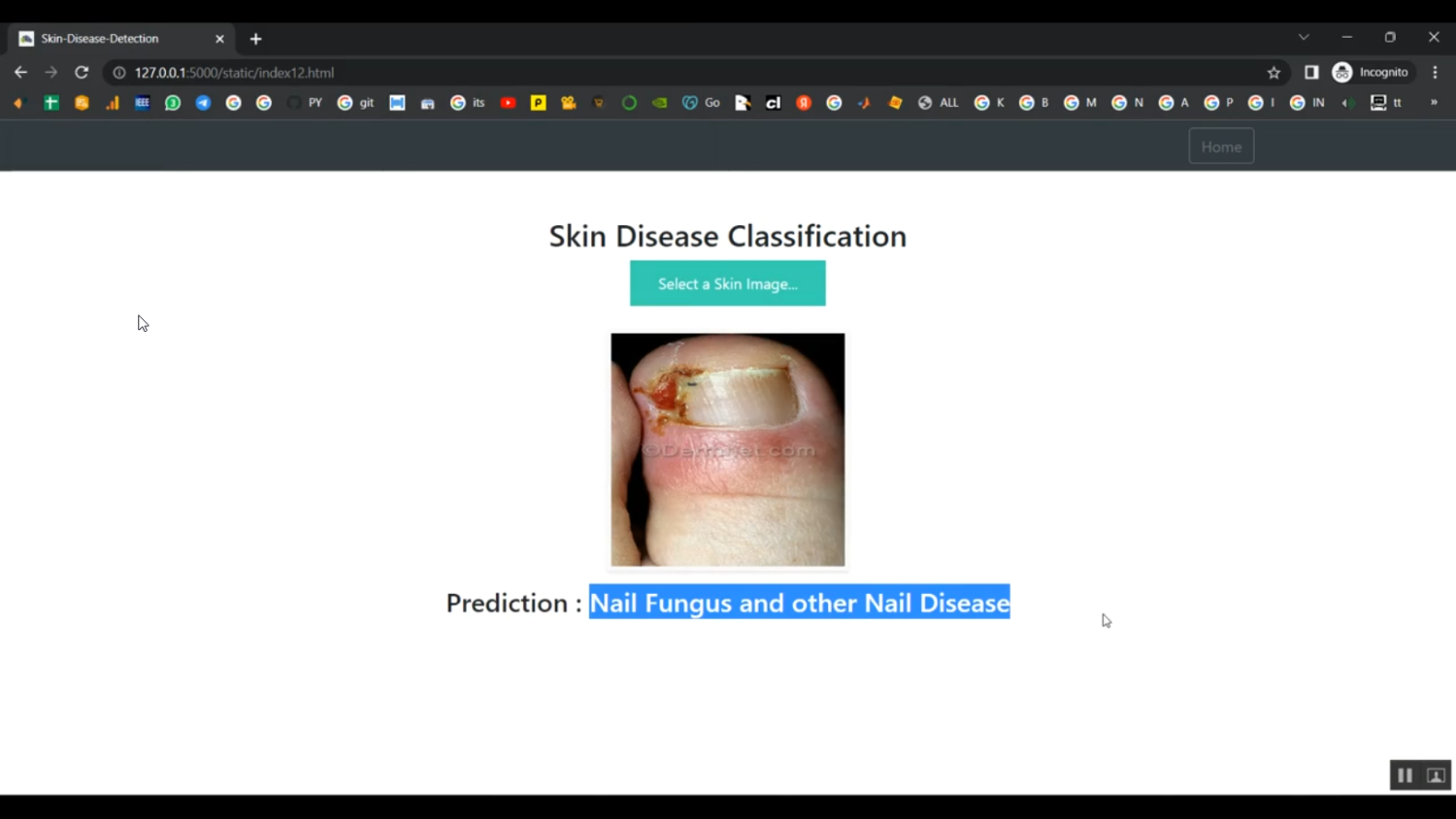 Skin Disease Detection Train Image Data Flask in Python Projects