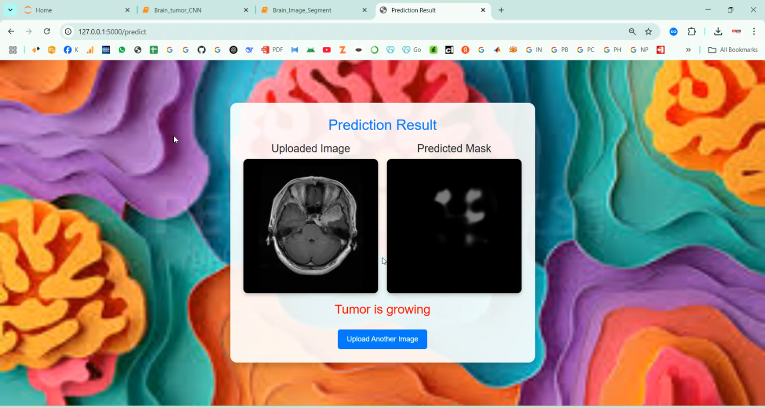 MRI Brain Image Segmentation using CNN in Python Projects