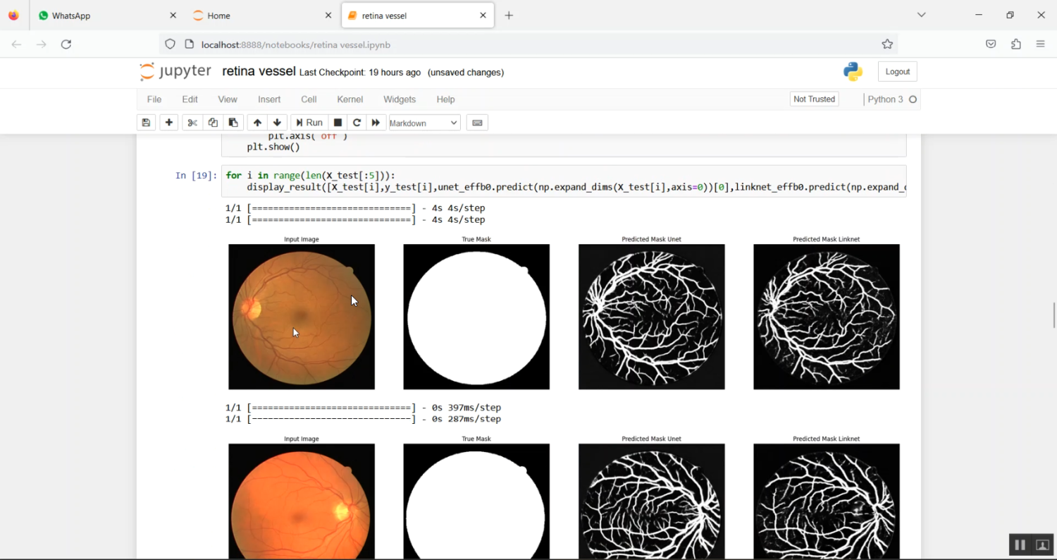 Retinal Vessel Image Analysis Jupyter Flask App in Python Projects