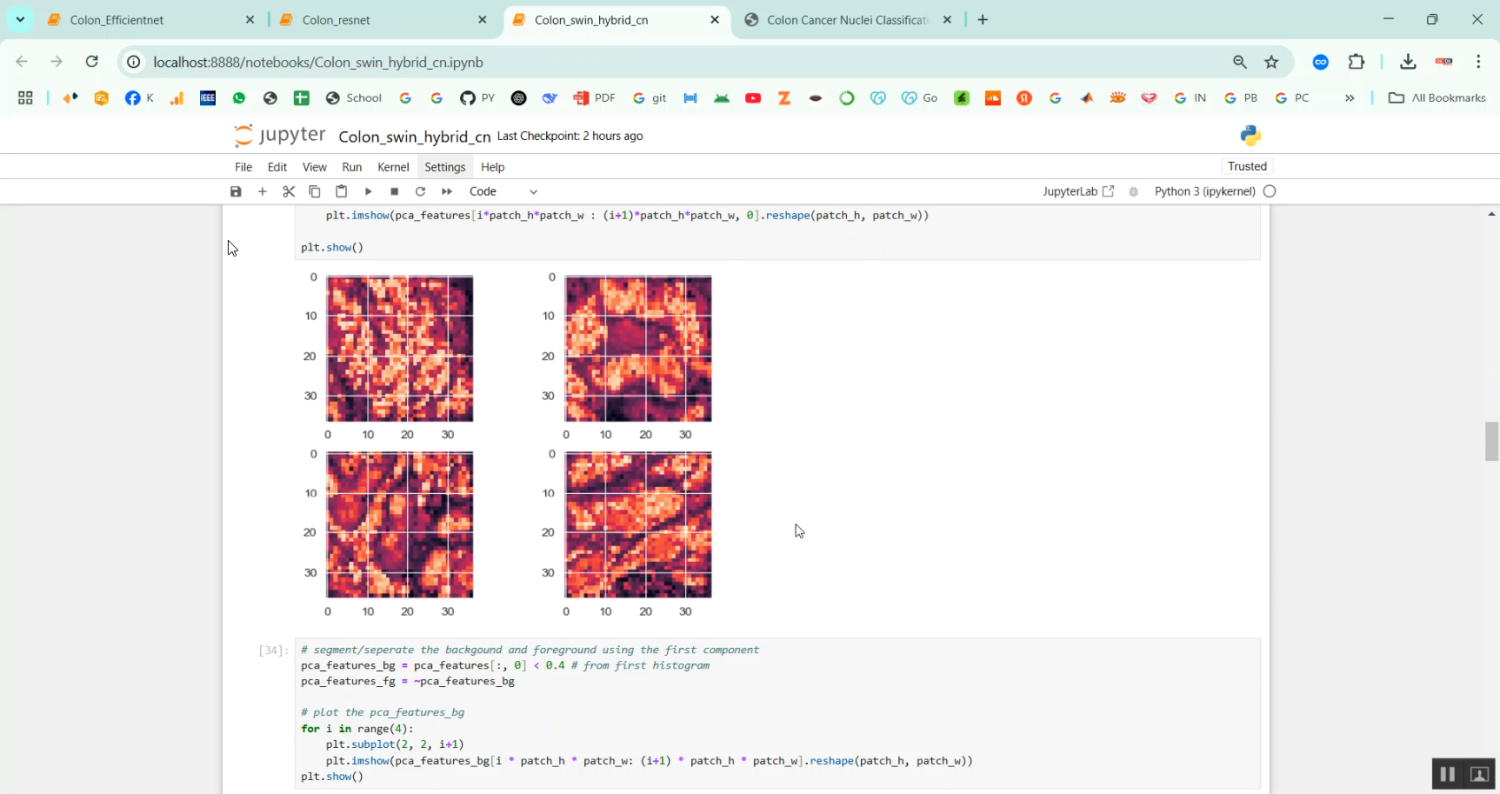 Colon Cancer Nuclei Classification in Python Projects
