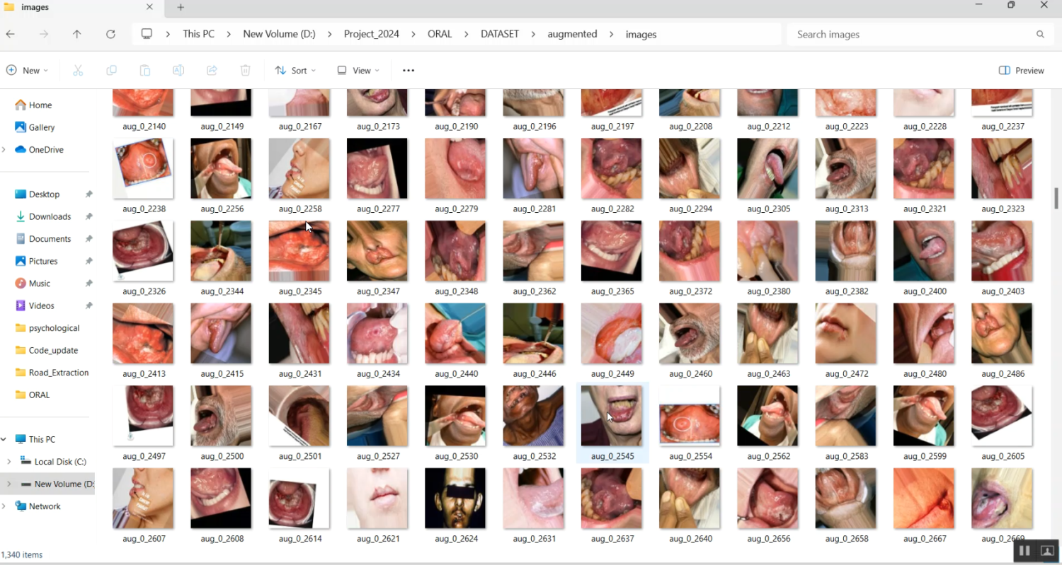 Oral Cancer Prediction Genetic Algorithm Streamlit in Python Projects