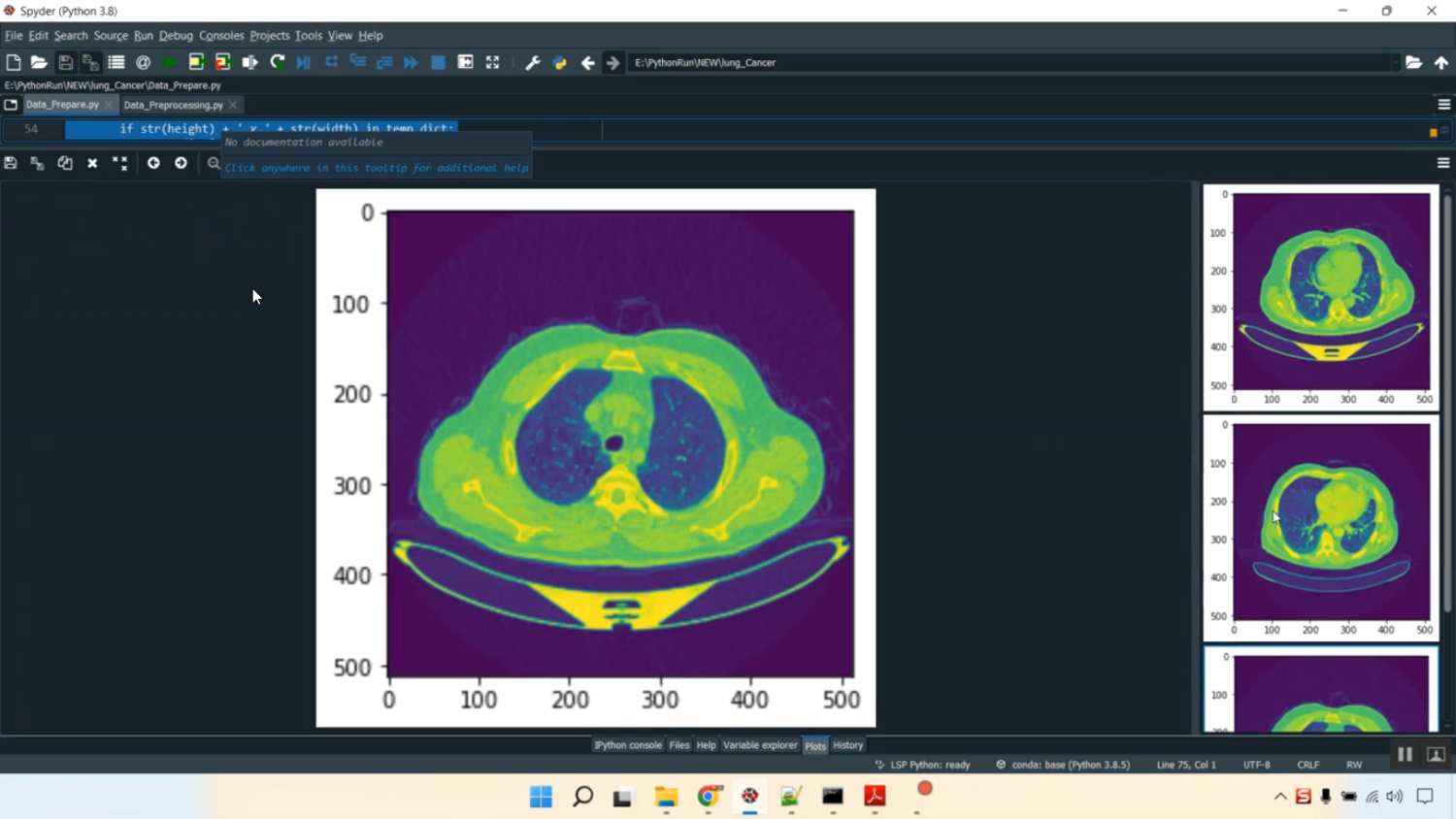 Lung Pancreatic Cancer CNN Train Flask App in Python Projects