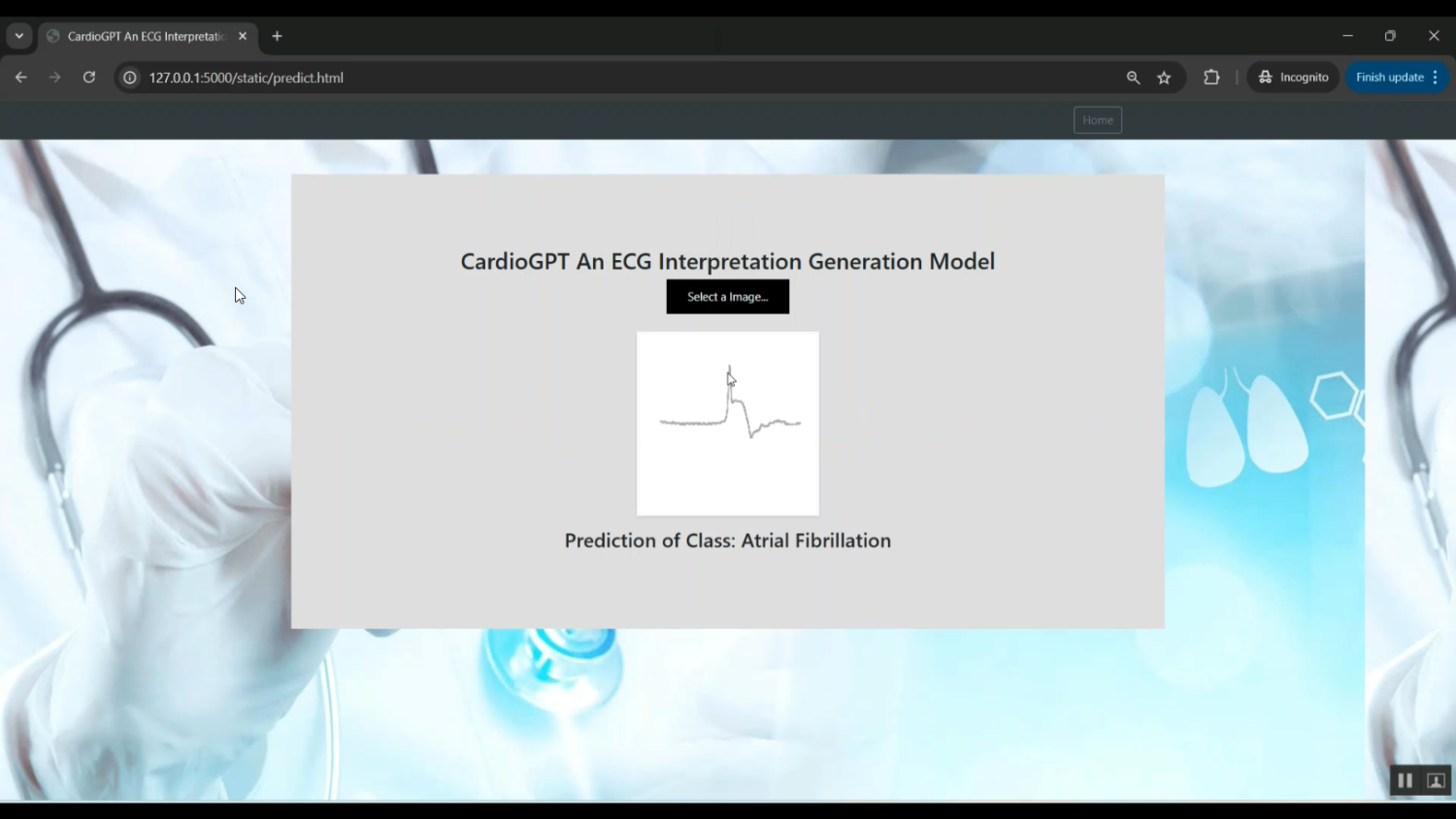 Cardio EEG Classification in Python Projects