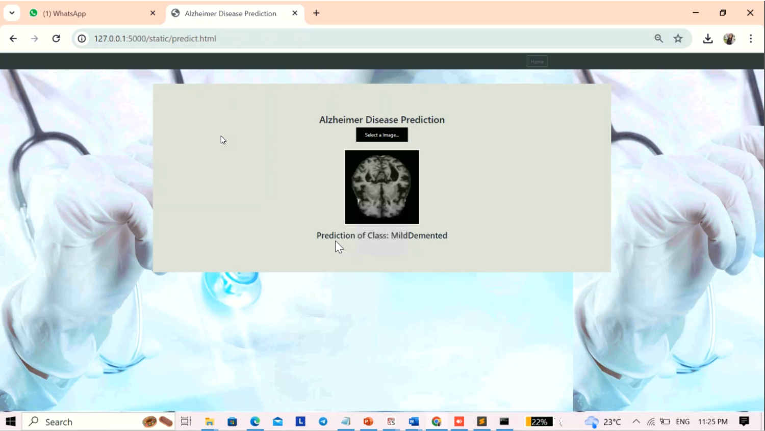 Alzheimer Disease Prediction in Python Projects