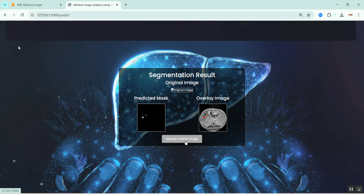 Liver Segmentation using Unet Medical Image Analysis in Python Projects