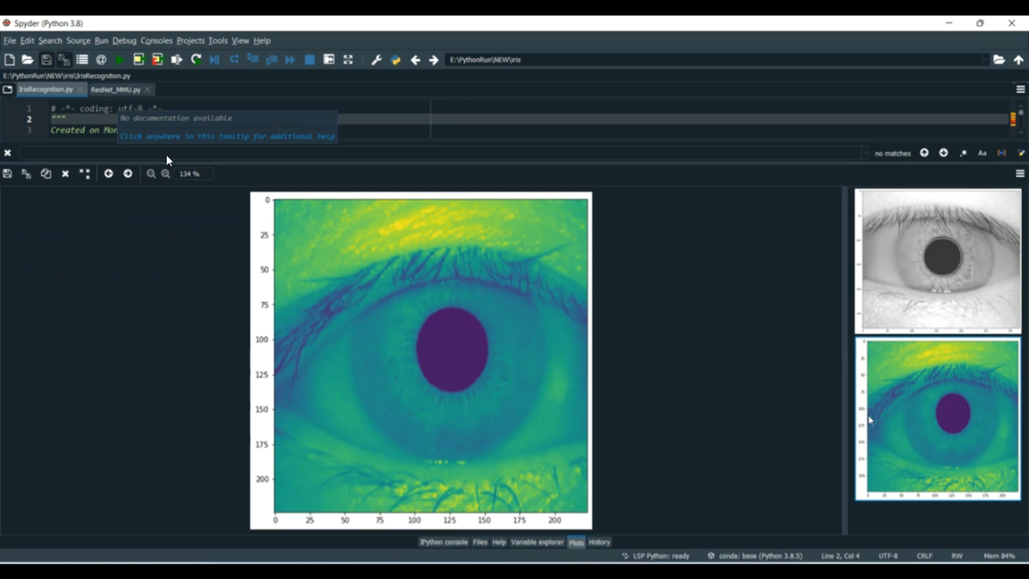 IRIS Recognition Training Image RetNet MMU in Python Projects