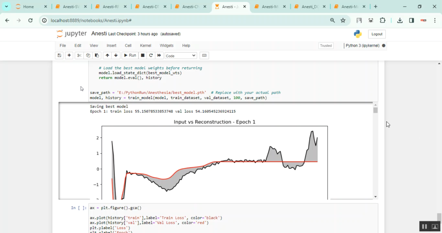 Anesthesia using EEG Data in Python Projects