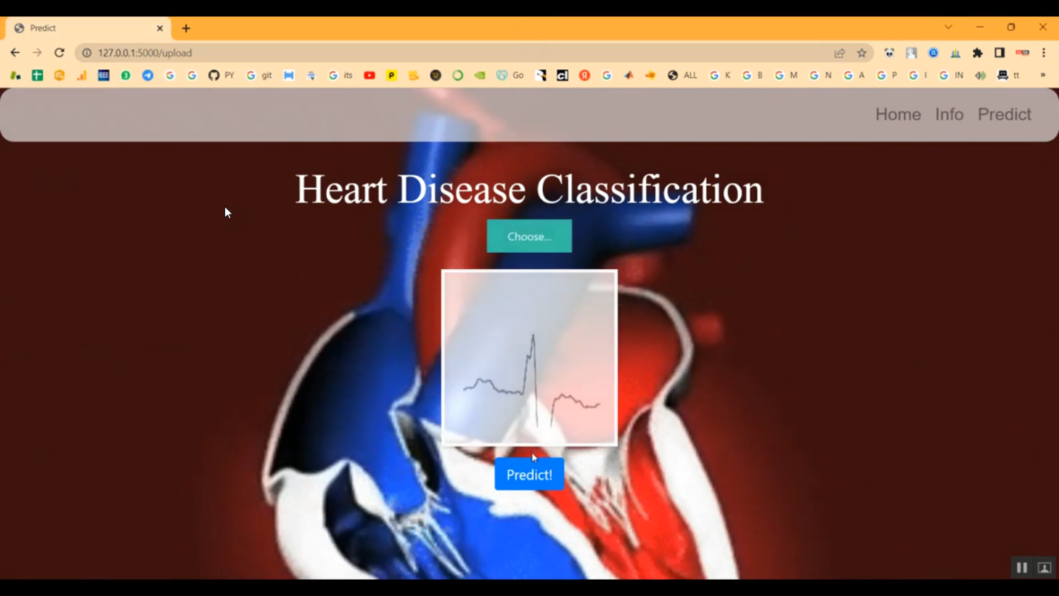 Heart disease Classification using CNN Train Image in Python Projects