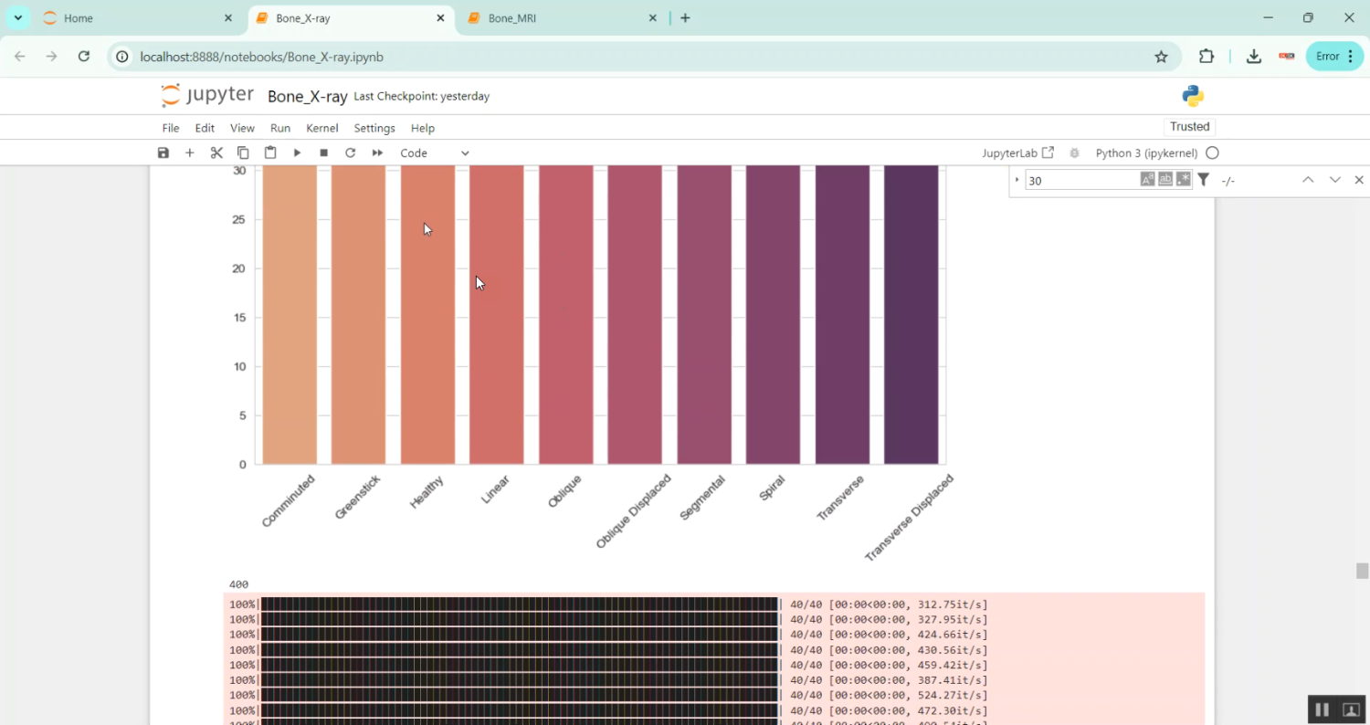 Bone X-Ray Jupiter in Python Projects
