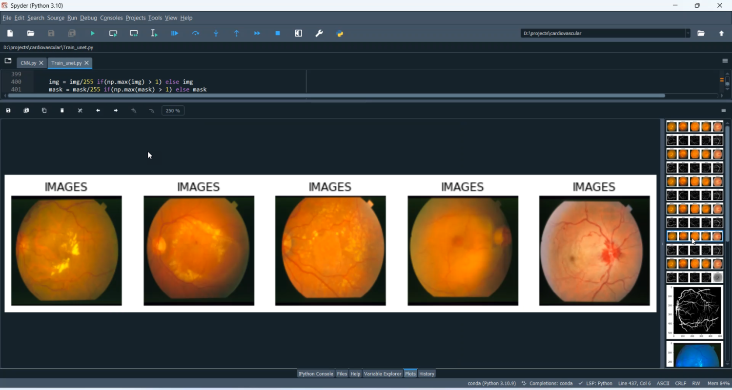 Cardiovascular Disease Classification in Python Projects