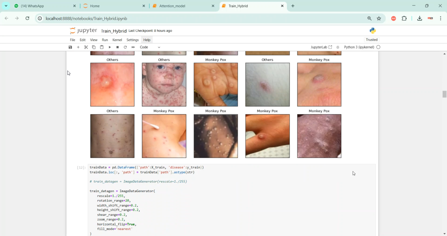 MonkeyPox Prediction System in Python Projects