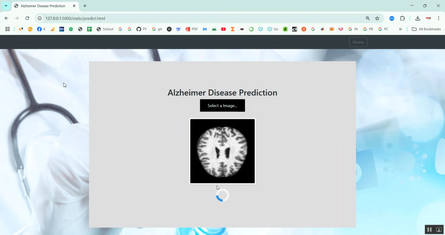 Alzheimer Disease Prediction in Python Projects