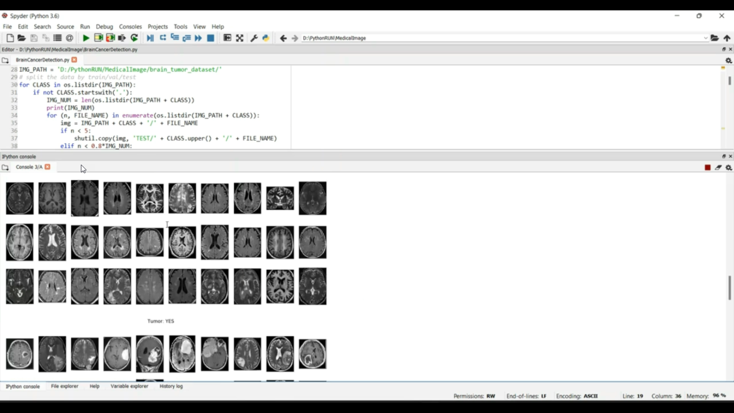 Medical Image Brain Tumor Image Dataset in Python Projects